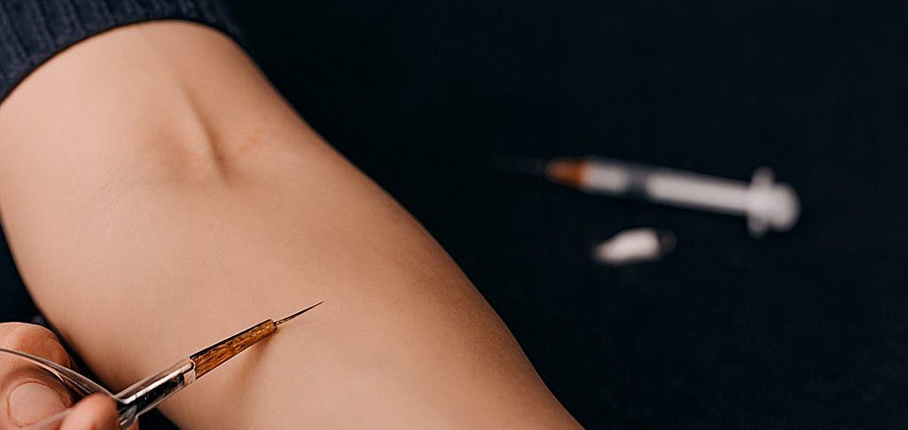 Heroin Addiction Treatment